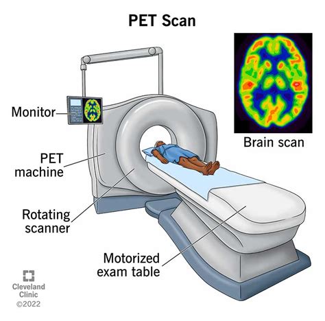 how to read pet scan results|PET Scan: Definition, Purpose, Procedure, and .